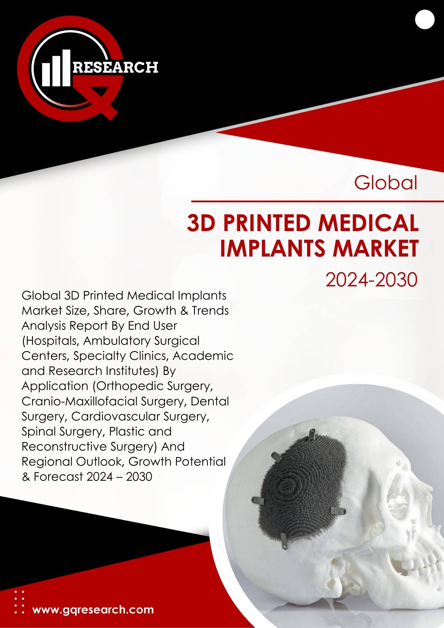 3D Printed Medical Implants Market Size, Share, Growth and Forecast to 2030 | GQ Research